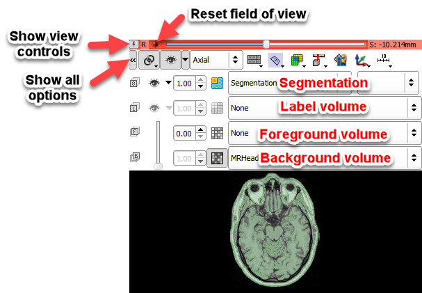 2d_slice_view_controls